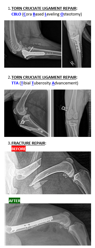 orthopedic surgery treatment